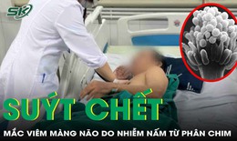 Người đ&#224;n &#244;ng su&#253;t mất mạng v&#236; vi&#234;m m&#224;ng n&#227;o do nhiễm nấm từ ph&#226;n chim

