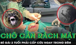 Cấp cứu ngay trong đêm cứu bé gái 2 tuổi bị chó nhà cắn rách mặt 
