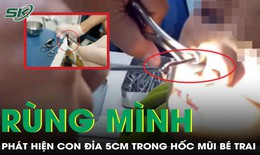Đi khám vì chảy máu mũi, bé trai khiến bác sĩ rùng mình khi gắp ra “dị vật”