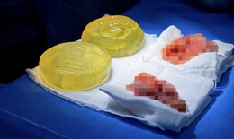 B&#225;c sĩ Hồ Cao Vũ: Kh&#243; khăn trong n&#226;ng ngực khi kh&#225;ch h&#224;ng sử dụng thực phẩm chức năng