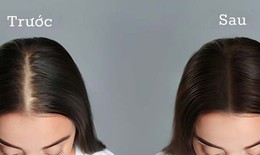 3 c&#225;ch gội đầu giảm rụng t&#243;c