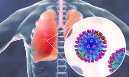 Nhận biết các viêm nhiễm đường hô hấp dưới thường gặp
