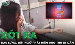 Cô gái 20 tuổi phát hiện mắc ung thư tuyến giáp di căn xương chỉ từ dấu hiệu đau lưng
