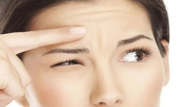 Nếp nhăn trán khi còn trẻ, làm sao để mờ dần?