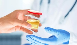 7 triệu chứng ban đầu của bệnh gan thường bị bỏ qua