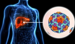 M&#249;a h&#232; cảnh gi&#225;c vi&#234;m gan A 