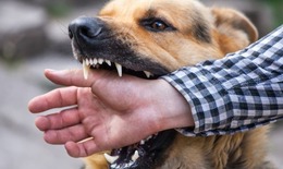 Về quê nghỉ hè, nhiều trẻ bị chó cắn