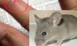 Những bệnh có thể lây nhiễm từ chuột và cách phòng