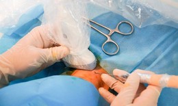 Đốt sóng cao tần điều trị u tuyến giáp lành tính không cần phẫu thuật