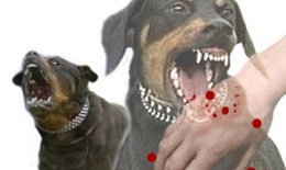 Sau 5 tháng bị chó nhà cắn, trẻ nguy kịch tính mạng vì mắc bệnh dại