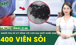 Bản tin Y tế 21/6: Đau bụng dữ dội do 400 viên sỏi 'chen chúc' trong túi mật