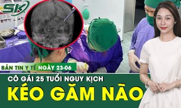 Bản tin Y tế 23/6: Cô gái 25 tuổi bị kéo nhọn đâm xuyên não