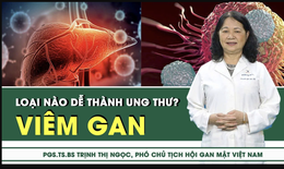 Viêm gan loại nào dễ tiến triển thành ung thư?