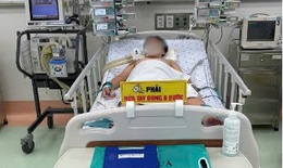 Bé trai đột ngột hôn mê, truỵ tim mạch sau khi hít phải lọ hoá chất hàn nhựa trong ô tô của bố