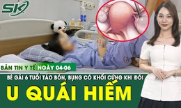 Bản tin Y tế 4/6: Bé gái 6 tuổi phát hiện u quái buồng trứng hiếm gặp từ dấu hiệu táo bón