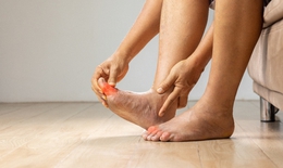 Axit uric cao c&#243; biểu hiện như thế n&#224;o?