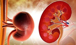 Suy thận có những biểu hiện gì?