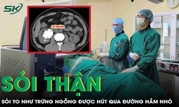 Phẫu thuật lấy sỏi thận to như quả trứng ngỗng cho người đ&#224;n &#244;ng 47 tuổi