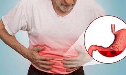 Nam bệnh nh&#226;n nguy kịch v&#236; xuất huyết ti&#234;u h&#243;a v&#224; c&#225;ch ph&#225;t hiện bệnh sớm