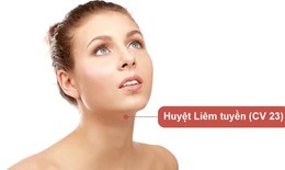 6 huyệt vị giúp cải thiện tình trạng ngủ ngáy
