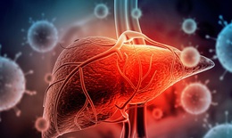 C&#225;ch hạ men gan tại nh&#224; hiệu quả