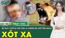 Bản tin Y tế 19/7: Bé trai 3 tuổi bị chó cắn lộ xương sọ, đứt tĩnh mạch