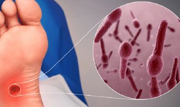 Chủ quan với vết thương nhỏ c&#243; thể mắc uốn v&#225;n nguy hiểm