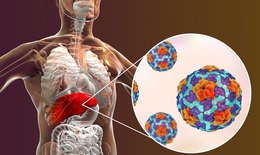 Mưa lũ gây nguy cơ mắc viêm gan A