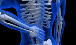 Viêm cột sống dính khớp có nguy hiểm không, những ai dễ mắc bệnh?