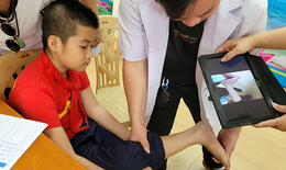 Khám sàng lọc và phẫu thuật miễn phí cho trẻ khuyết tật tại tỉnh Quảng Trị