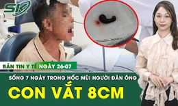 Bản Tin Y Tế 26/7: Ph&#225;t hiện con vắt 8cm c&#242;n sống trong hốc mũi người đ&#224;n &#244;ng 
