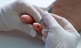 C&#243; n&#234;n ch&#237;ch đầu ng&#243;n tay khi đột quỵ?