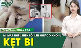 Bản Tin Y Tế 27/7: Vi&#234;n bi sắt 6mm kẹt trong m&#237; mắt thiếu ni&#234;n 15 tuổi