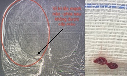 Li&#234;n tục tiếp nhận bệnh nh&#226;n đột quỵ, khuyến c&#225;o của b&#225;c sĩ