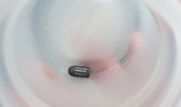 &#39;Đạn lạc&#39; găm v&#224;o đầu khi đang l&#224;m vườn, người phụ nữ may mắn tho&#225;t chết