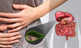 Sỏi mật gây biến chứng gì?