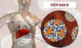 Biểu hiện của vi&#234;m gan B giai đoạn đầu