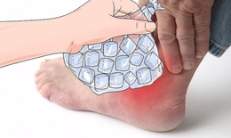 Cách giảm đau nhanh cơn gout cấp