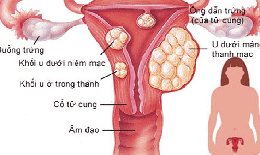 Chuyển đổi số ng&#224;nh y tế: H&#224;nh tr&#236;nh &#39;ph&#242;ng bệnh hơn chữa bệnh&#39; của hai người phụ nữ Thủ đ&#244;