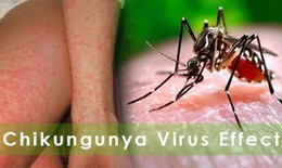 Bộ Y tế: Tăng cường giám sát dịch Chikungunya ngay tại cửa khẩu, cơ sở y tế, cộng đồng để phát hiện sớm ca bệnh