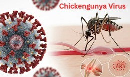 Muỗi đốt truyền bệnh Chikungunya lưu hành tại nhiều địa phương, Bộ Y tế nói gì về nguy cơ dịch bệnh này?
