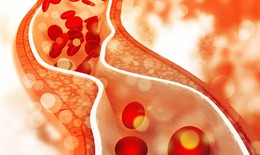 Rối loạn lipid m&#225;u ở bệnh nh&#226;n tiểu đường cần lưu &#253; g&#236;?