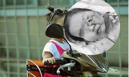 B&#233; 26 th&#225;ng tuổi chấn thương mắt, m&#244;i, dập phổi do rồ ga xe m&#225;y
