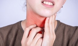 Đau họng kéo dài do viêm amidan hốc mủ