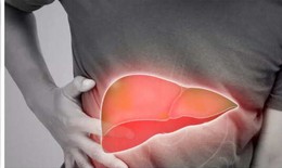 5 th&#243;i quen h&#224;ng ng&#224;y c&#243; thể đẩy gan nhiễm mỡ tới ung thư v&#224; c&#225;ch ph&#242;ng ngừa
