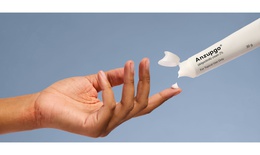 Kem dưỡng da không chứa steroid trị bệnh chàm tay