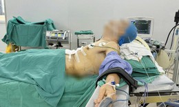 Bệnh nhân 'nửa nằm, nửa ngồi' trong ca phẫu thuật ung thư dạ dày
