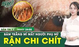 Bản Tin Y Tế 24/8: Rận mu và trứng bám trắng mi hai mắt người phụ nữ