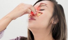 Viêm xoang mũi dị ứng chữa thế nào?