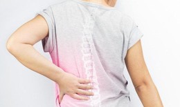 C&#225;ch bổ sung canxi ph&#242;ng ngừa lo&#227;ng xương cho phụ nữ m&#227;n kinh